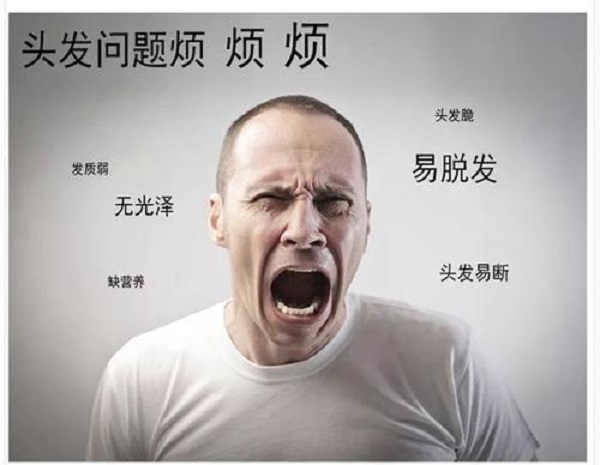 如何预防男性脱发