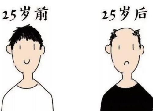 男性脂溢性脱发为何这么容易出现？