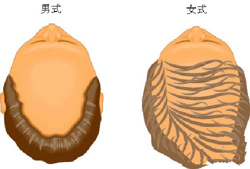 男人秃发是怎么回事,男人秃发是什么原因造成的